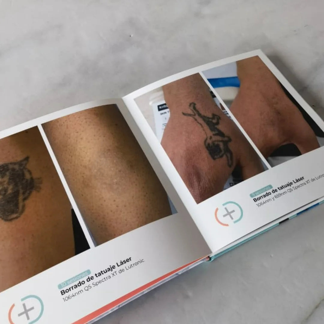 Imagewrap 180 Grados